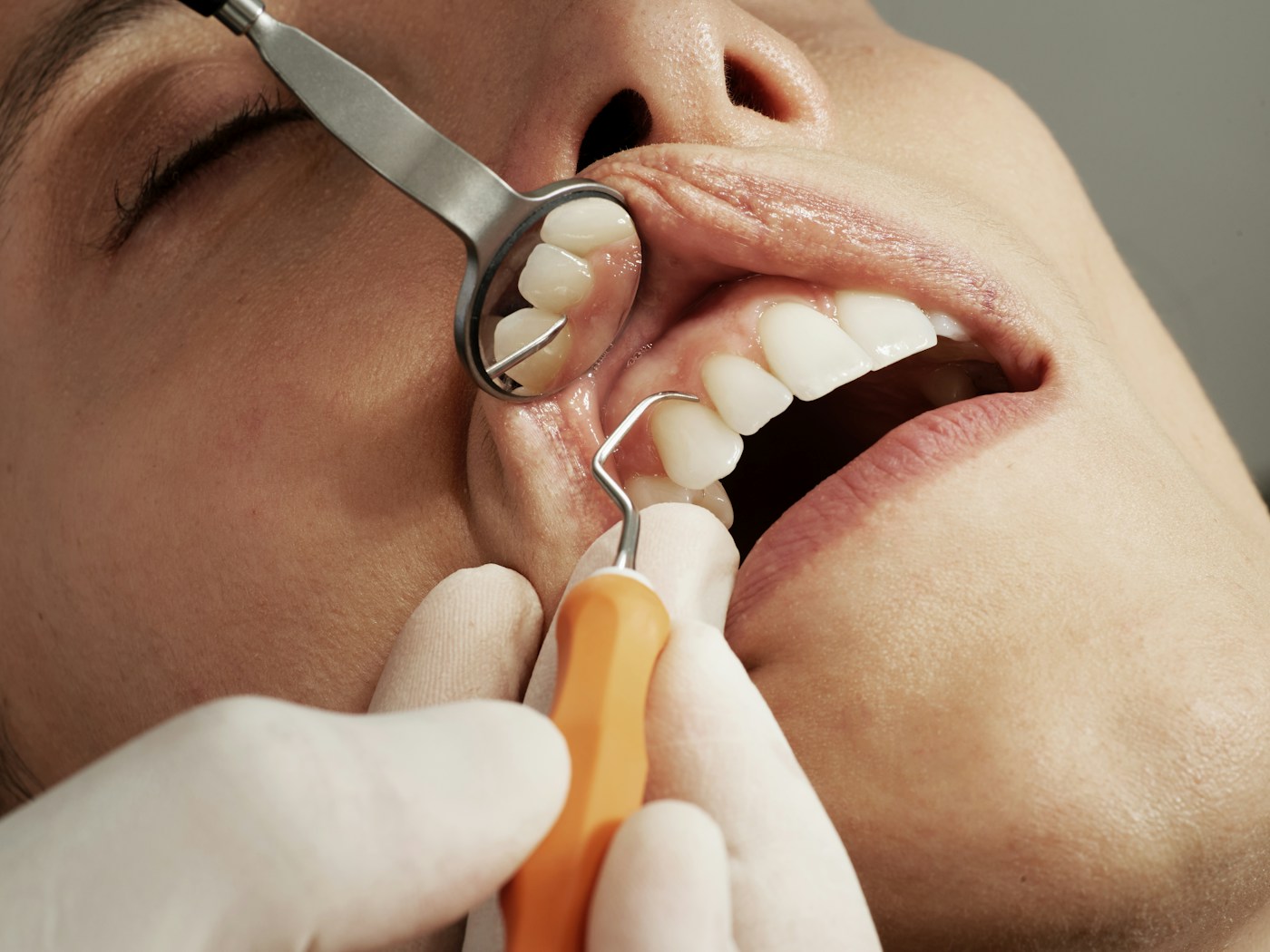 Bác sĩ sử dụng dụng cụ nha khoa
